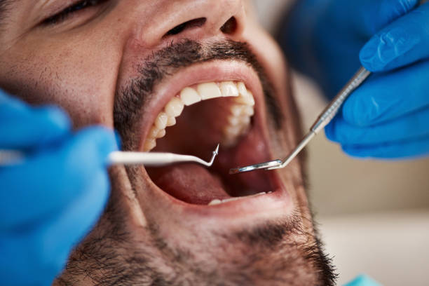 Best Broken Tooth Emergency  in Beaver Dam, WI