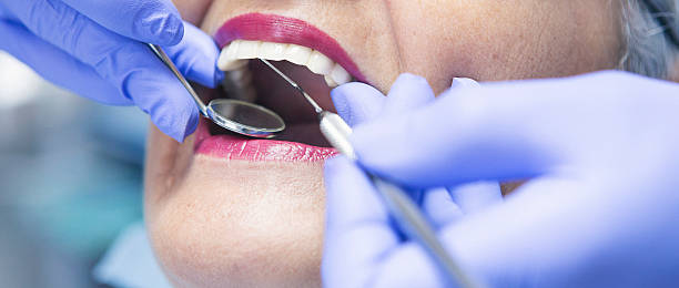 Best Knocked-Out Tooth Emergency  in Beaver Dam, WI